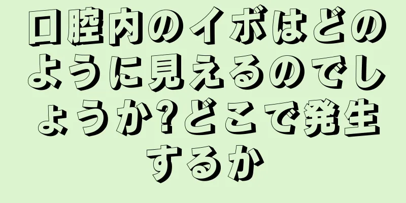 口腔内のイボはどのように見えるのでしょうか?どこで発生するか
