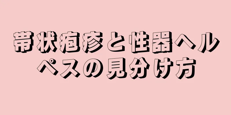 帯状疱疹と性器ヘルペスの見分け方