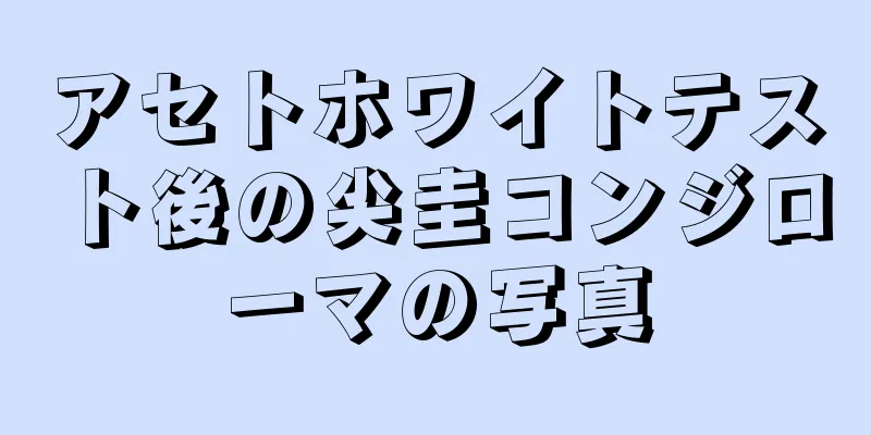 アセトホワイトテスト後の尖圭コンジローマの写真