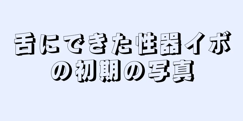 舌にできた性器イボの初期の写真