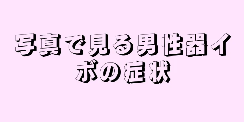 写真で見る男性器イボの症状