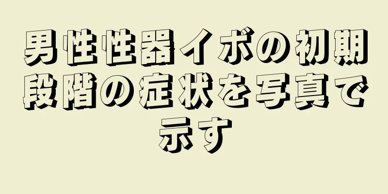 男性性器イボの初期段階の症状を写真で示す